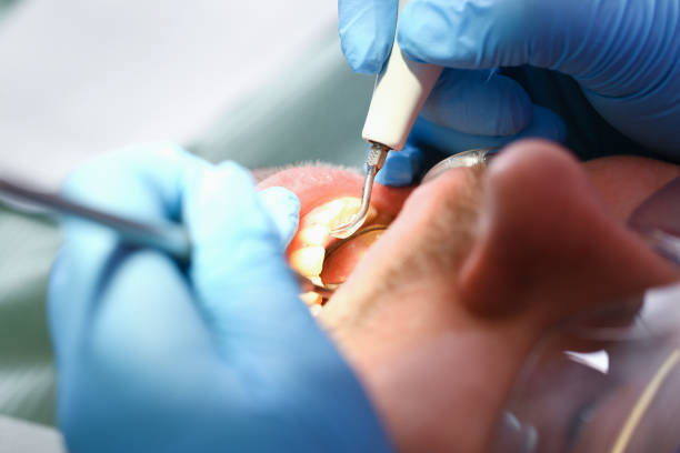 Best Mobile Emergency Dentist in Travis Ranch, TX