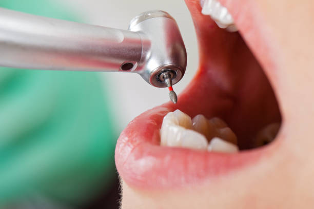 Best Orthodontic Emergency Dentist in Travis Ranch, TX